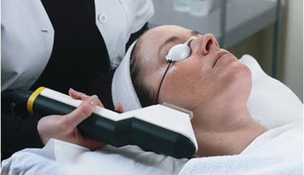 tractament laser rejoveniment pell taques cara